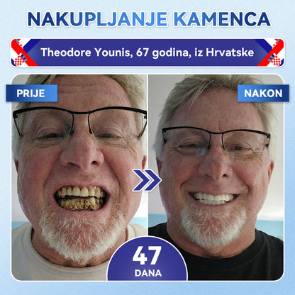 Glimmerly®🦷 Tideglusib Flaster s mikroiglicama za popravak zuba i desni 💳 Plaćanje pouzećem (Obnavlja caklinu i dentin • Jača desni • Uklanja kamenac i neugodan miris • Smanjuje osjetljivost zuba) 🍋