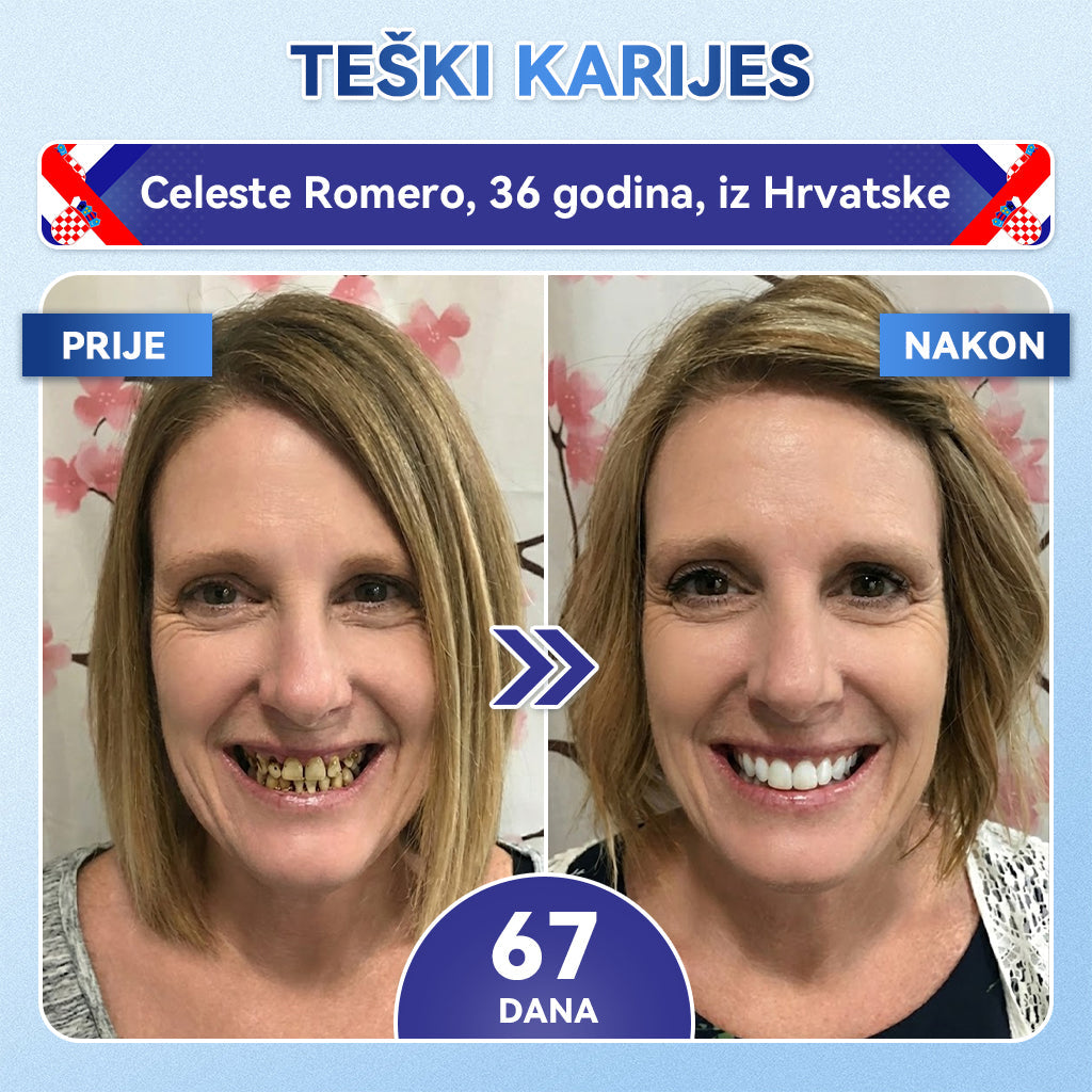 Glimmerly®🦷 Tideglusib Flaster s mikroiglicama za popravak zuba i desni 💳 Plaćanje pouzećem (Obnavlja caklinu i dentin • Jača desni • Uklanja kamenac i neugodan miris • Smanjuje osjetljivost zuba) 🍋