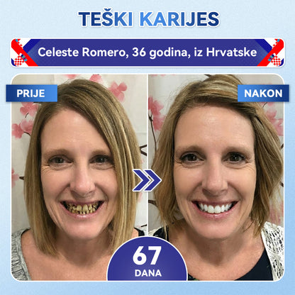 Glimmerly®🦷 Tideglusib Flaster s mikroiglicama za popravak zuba i desni 💳 Plaćanje pouzećem (Obnavlja caklinu i dentin • Jača desni • Uklanja kamenac i neugodan miris • Smanjuje osjetljivost zuba) 🍋