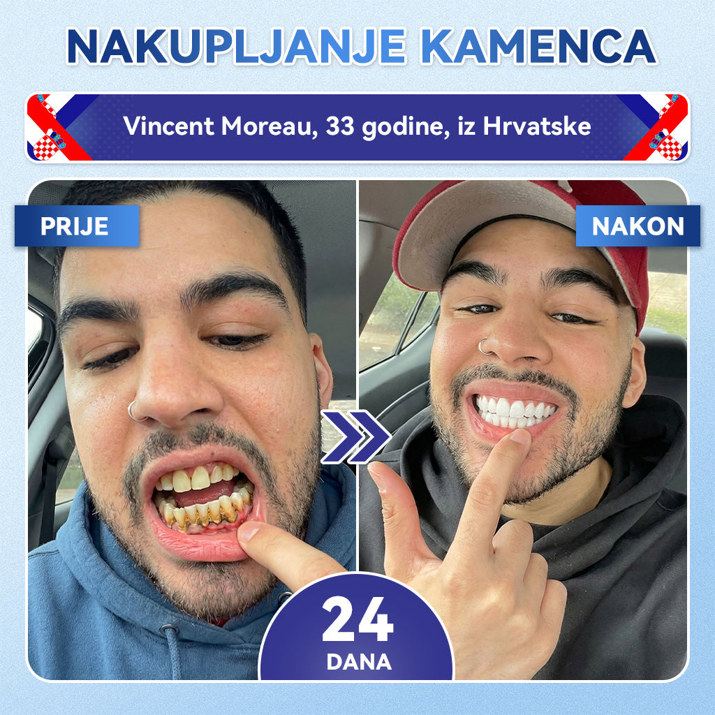 Glimmerly®🦷 Tideglusib Flaster s mikroiglicama za popravak zuba i desni 💳 Plaćanje pouzećem (Obnavlja caklinu i dentin • Jača desni • Uklanja kamenac i neugodan miris • Smanjuje osjetljivost zuba) 🍋