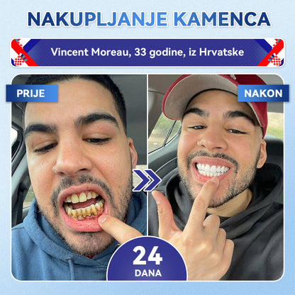 Glimmerly®🦷 Tideglusib Flaster s mikroiglicama za popravak zuba i desni 💳 Plaćanje pouzećem (Obnavlja caklinu i dentin • Jača desni • Uklanja kamenac i neugodan miris • Smanjuje osjetljivost zuba) 🍋