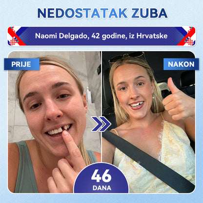 Glimmerly®🦷 Tideglusib Flaster s mikroiglicama za popravak zuba i desni 💳 Plaćanje pouzećem (Obnavlja caklinu i dentin • Jača desni • Uklanja kamenac i neugodan miris • Smanjuje osjetljivost zuba) 🍋