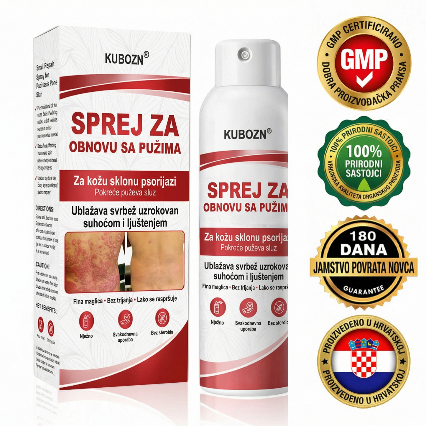 KUBOZN® 🎉SPREJ ZA OBNOVU SA PUZIMA za svrbežnu, perutavu kožu kod psorijaze 🎁