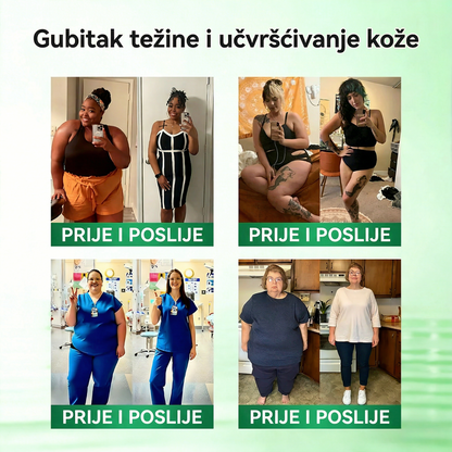 Plaćanje pouzećem dostupno 【Posljednji dan akcije: 70 % popusta】  Florisma® 👩‍⚕️Moringa & Berberin 10-u-1 Napredni Nano Mikroiiglički Flaster Pogodno za pretilost, dijabetes, apneju u snu i probleme s zglobovima 🌱