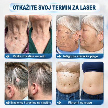𝐏i𝐜𝐝o®🍀 𝟕-𝐝𝐧𝐞𝐯𝐧𝐢 𝐨𝐝𝐬𝐭𝐫𝐚𝐧𝐣𝐢𝐯𝐚č 𝐛𝐫𝐚𝐝𝐚𝐯𝐢𝐜𝐚 𝐢 𝐦𝐫𝐥𝐢𝐚(Rollerball bez boli, bez ožiljaka)🌽