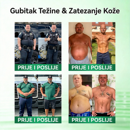 Plaćanje pouzećem dostupno 【Posljednji dan akcije: 70 % popusta】  Florisma® 👩‍⚕️Moringa & Berberin 10-u-1 Napredni Nano Mikroiiglički Flaster Pogodno za pretilost, dijabetes, apneju u snu i probleme s zglobovima 🌱