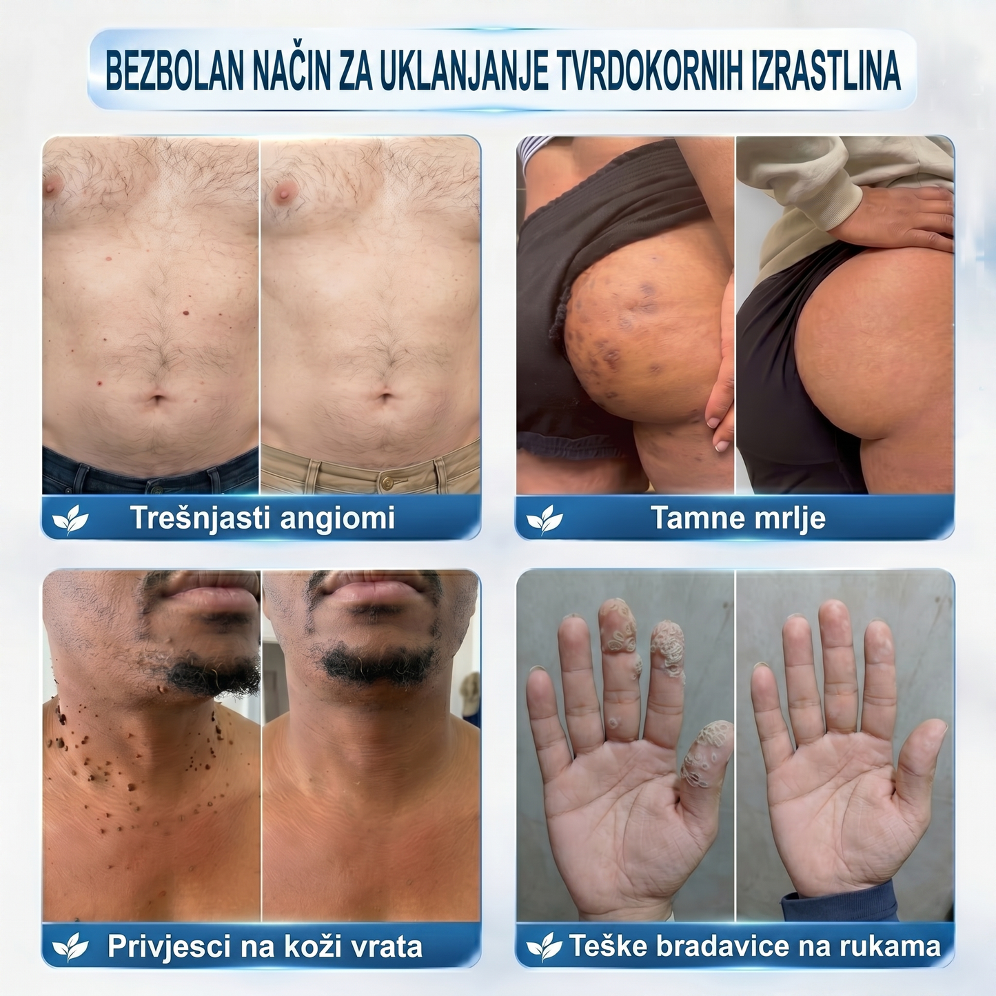 𝐏i𝐜𝐝o®🍀 𝟕-𝐝𝐧𝐞𝐯𝐧𝐢 𝐨𝐝𝐬𝐭𝐫𝐚𝐧𝐣𝐢𝐯𝐚č 𝐛𝐫𝐚𝐝𝐚𝐯𝐢𝐜𝐚 𝐢 𝐦𝐫𝐥𝐢𝐚(Rollerball bez boli, bez ožiljaka)🌽