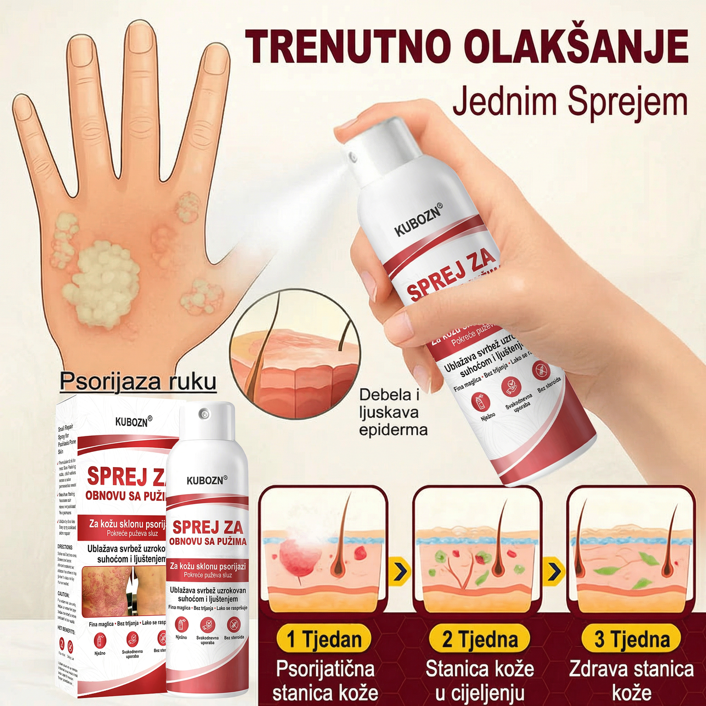 KUBOZN® 🎉SPREJ ZA OBNOVU SA PUZIMA za svrbežnu, perutavu kožu kod psorijaze 🎁