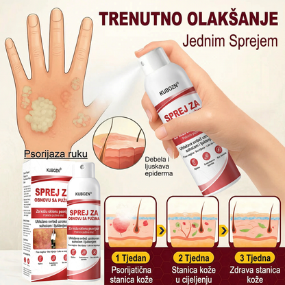 KUBOZN® 🎉SPREJ ZA OBNOVU SA PUZIMA za svrbežnu, perutavu kožu kod psorijaze 🎁