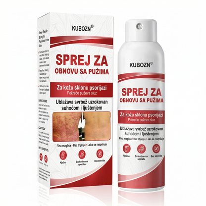 KUBOZN® 🎉SPREJ ZA OBNOVU SA PUZIMA za svrbežnu, perutavu kožu kod psorijaze 🎁